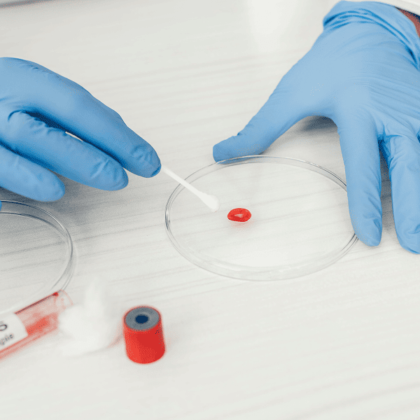 Анализ крови на сифилис (RW-реакция Вассермана)