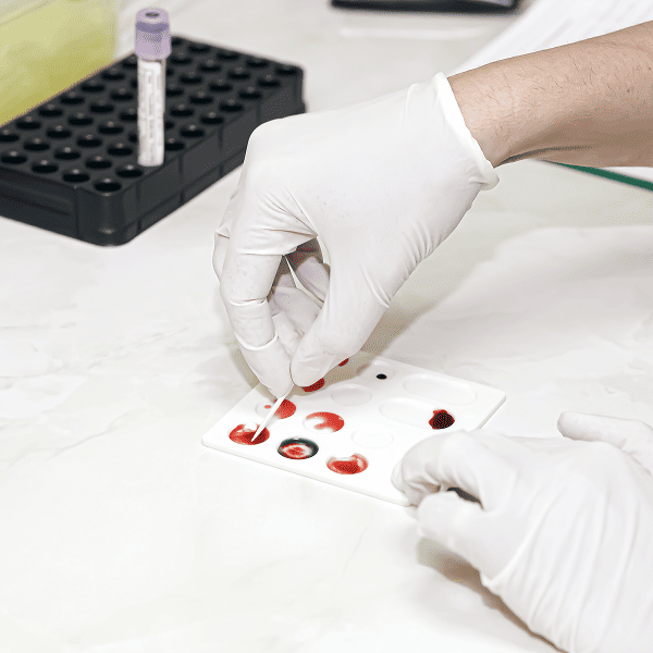 Анализ крови на скрытые инфекции