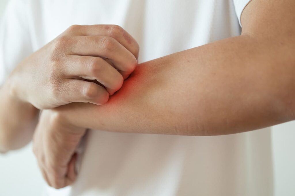 Симптомы дерматита и аллергии: в чем разница