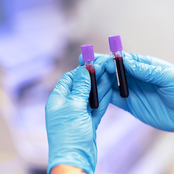 Клинический анализ крови